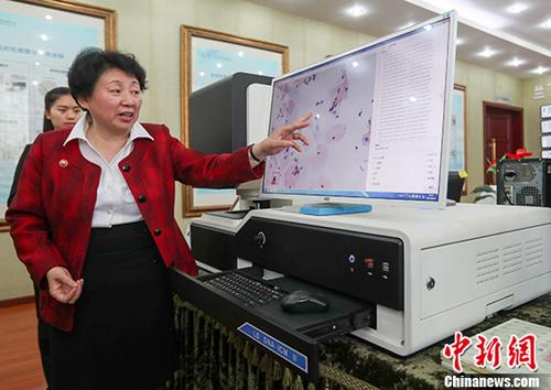 中國宮頸癌篩查技術(shù)獲世衛(wèi)組織資格認證