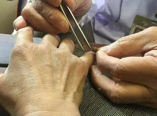 70歲老中醫(yī)養(yǎng)幾萬(wàn)只蜜蜂 病人排隊(duì)等著被蜇