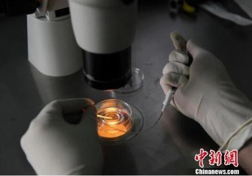 資料圖：胚胎移植技術(shù)。圖文無關(guān)。張瑤 攝