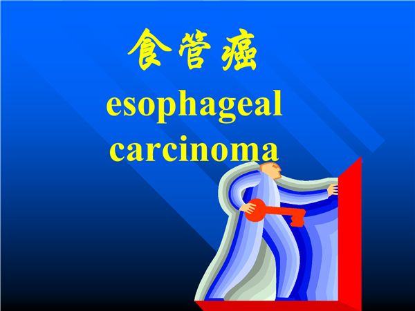 恒瑞發(fā)布卡瑞利珠單抗新研究結果 食管癌或將有免疫療法
