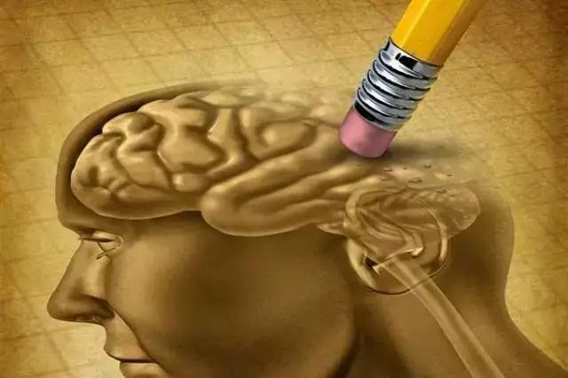 研究顯示睡眠不足可能增加罹患阿爾茨海默病風險