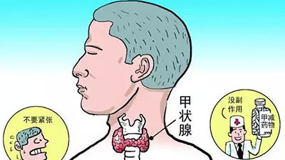 甲狀腺長結(jié)節(jié) 難道離癌不遠(yuǎn)了？！