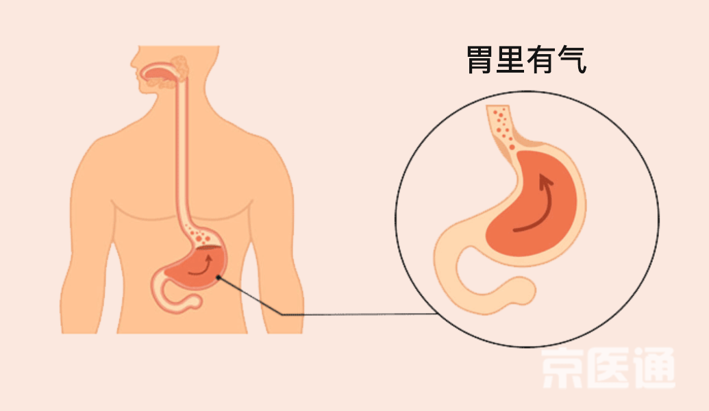 宣醫(yī)科普|突然打嗝又止不?。酷t(yī)生給出了3種科學(xué)方法！