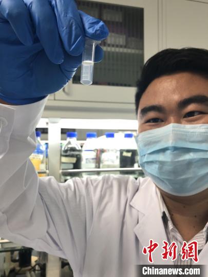 國際重大顛覆性突破 中國首次在實驗室實現(xiàn)人工合成淀粉