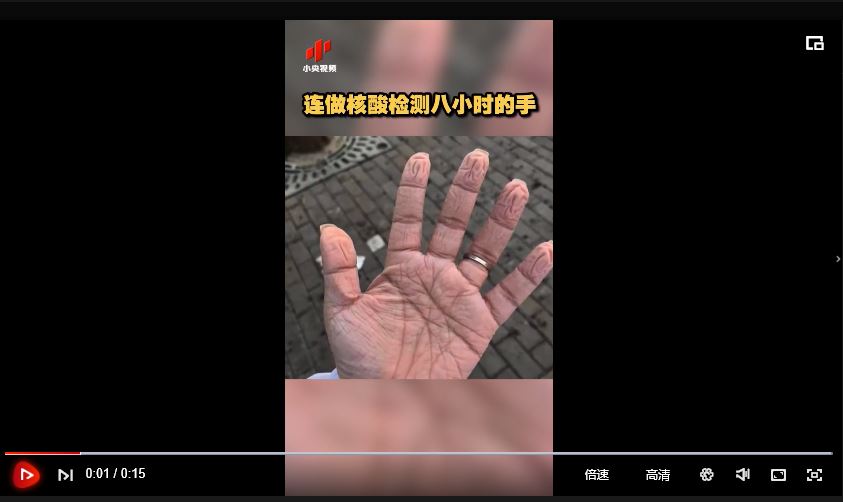 連做核酸檢測(cè)八小時(shí)的手