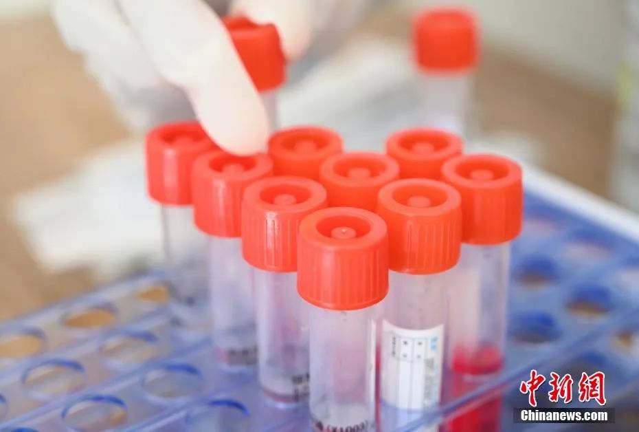 核酸報告“假陽性”？核酸檢測機構也得檢測
