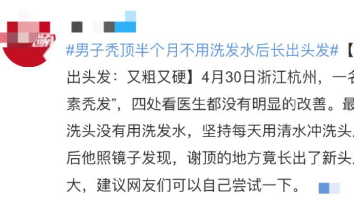 每天洗頭會(huì)加重脫發(fā)嗎？