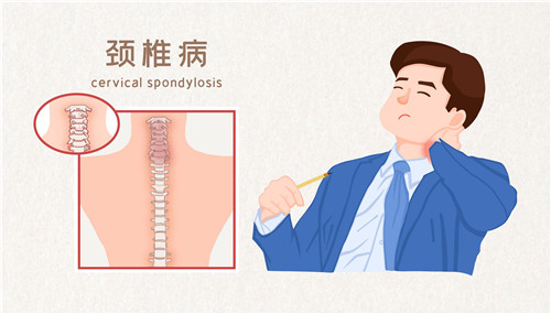 網(wǎng)傳頸椎病“自救指南”靠譜嗎？專(zhuān)家解讀來(lái)了