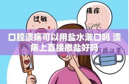 口腔潰瘍 撒鹽喝酒消毒有用嗎？