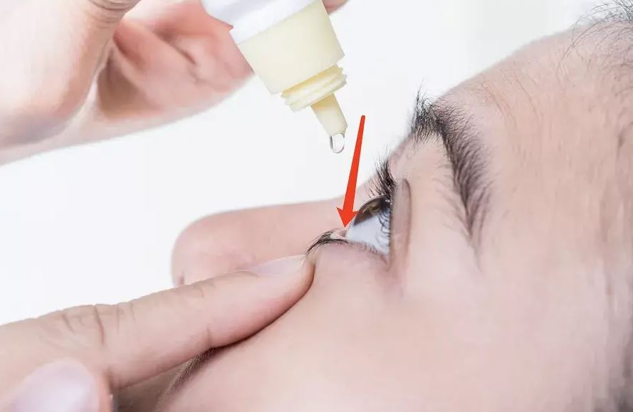 滴眼藥后眨眼還是閉眼？很多人都做錯(cuò)了！